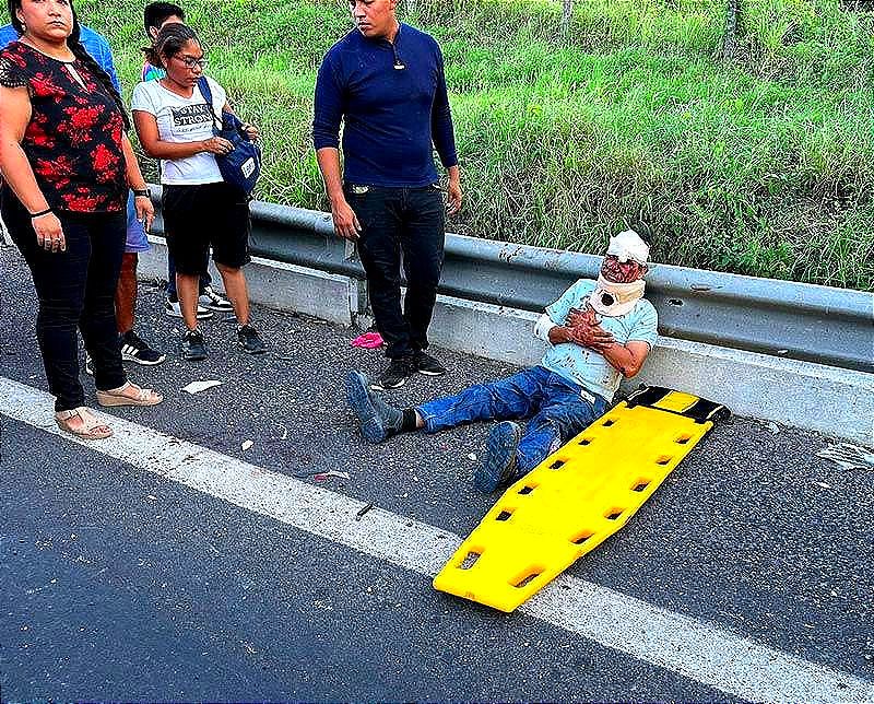 Trailero Los Embiste Y Viven De Milagro En La Autopista Cardel