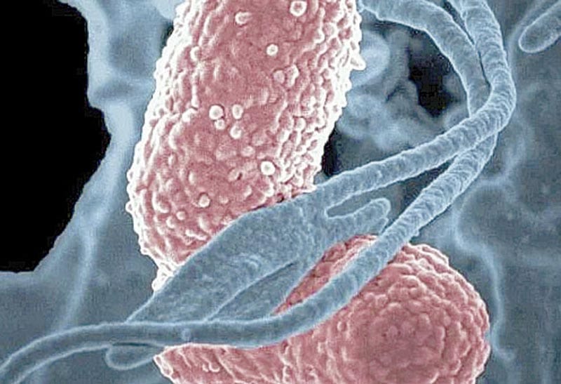 Trece Ni Os Mueren Por Brote De La Bacteria Klebsiella Oxytoca