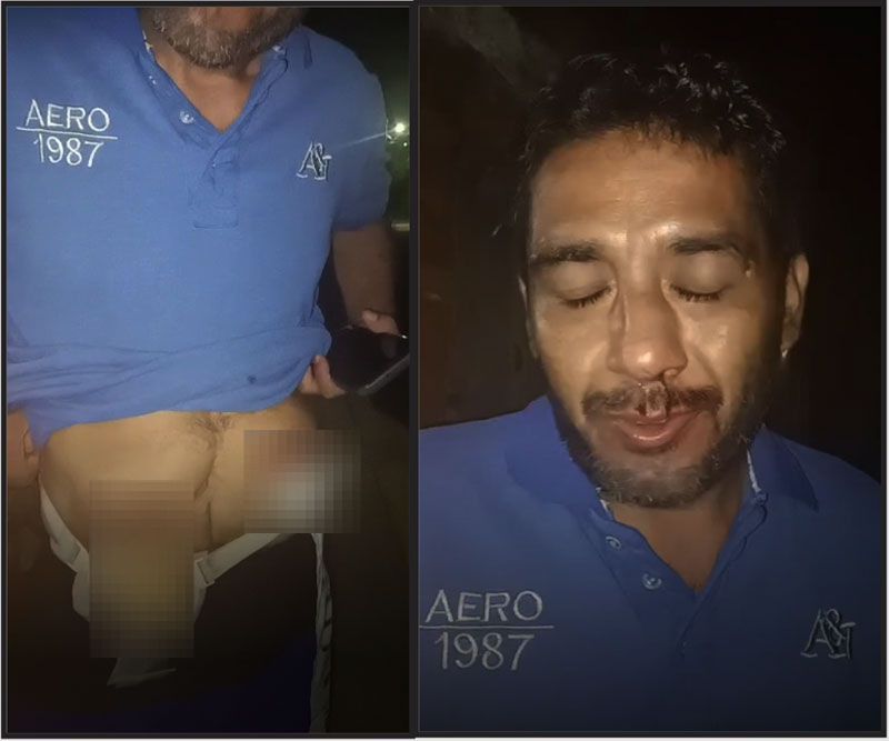 ¡LE DAN UNA GOLPIZA, LLAMÓ A POLICÍAS Y PC PERO SE NEGARON A AYUDARLO!