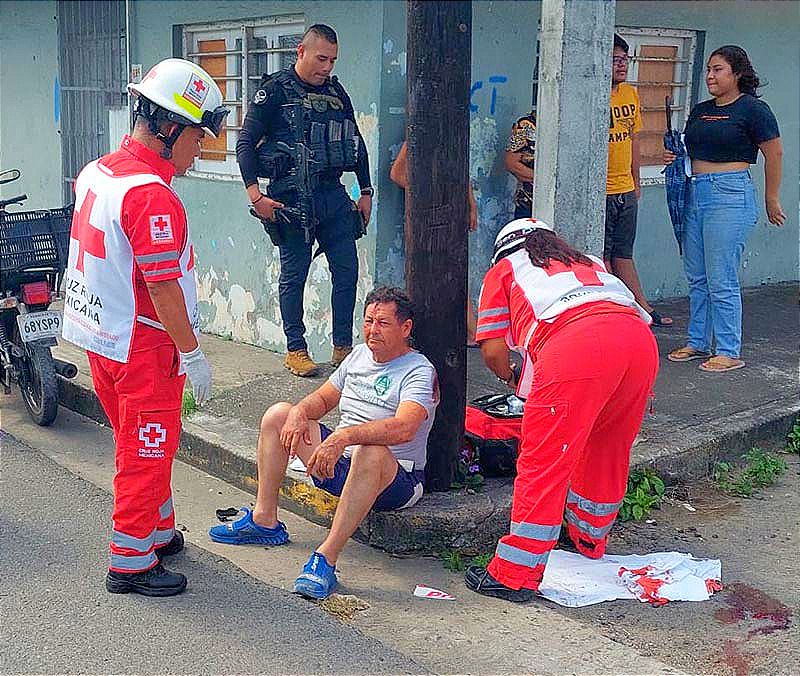 ¡MOTORIZADO ESQUIVA AUTO Y SE ESTRELLA CONTRA POSTE! -No logró quitarse el poste...