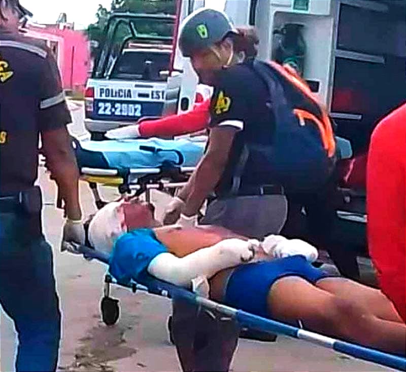 ¡PIERDE EL BRAZO POR GRANADAZO! - HUBO OTRO LESIONADO MÁS PERO HUYÓ EN UNA MOTOCICLETA