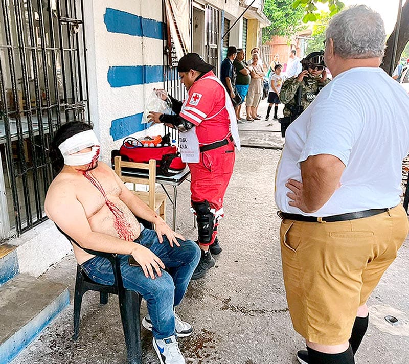 ¡CASI LE ARRANCA UN OJO! - TODO POR UN CHOQUE POR ALCANCE