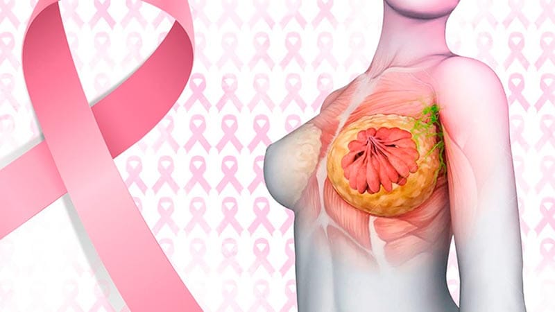 TIPS PARA MEJORAR LA CALIDAD DE VIDA | FACTORES DE RIESGO DE CÁNCER MAMARIO - Qué tal amigos lectores, he recibido varias preguntas de ustedes (principalmente mujeres) que muestran una gran preocupación por el tema del cáncer de mama...