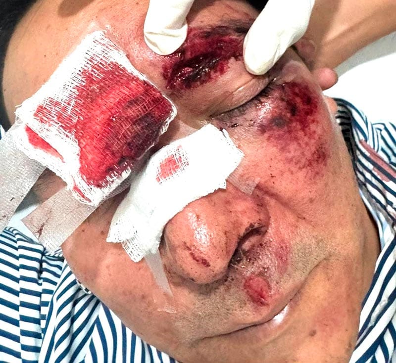 ¡EX DIPUTADO PANISTA HERIDO EN APARATOSO ACCIDENTE EN LA CIUDAD DE MÉXICO!