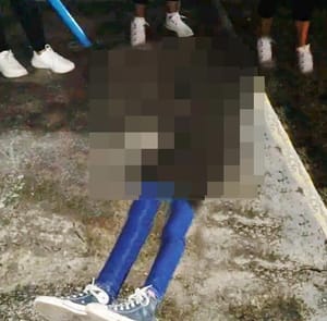 ¡NIÑA CAE DE APARATO DE EJERCICIO Y SE GOLPEÓ LA CABEZA!