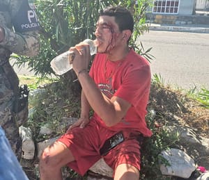 ¡MOTORIZADO HERIDO EN UN “TORTAZO”!