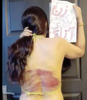 ¡MUJER IRANÍ ES SOMETIDA A 74 LATIGAZOS POR NO CUBRIR SU CABELLO EN PÚBLICO!