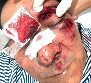 ¡EX DIPUTADO PANISTA HERIDO EN APARATOSO ACCIDENTE EN LA CIUDAD DE MÉXICO!