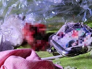 ¡‘REGALO-BOMBA’ LE VOLO LA MANO! - ALBAÑIL RESULTÓ HERIDO AL EXPLOTAR UN FRASCO DE PERFUME QUE ABRIÓ