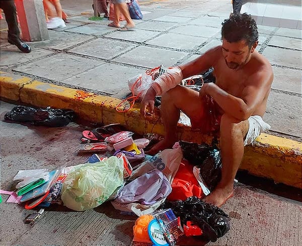 ¡LE DAN UNA PALIZA! - *Tenía una herida en el brazo y se encontraba bajo los efectos del alcohol y drogas