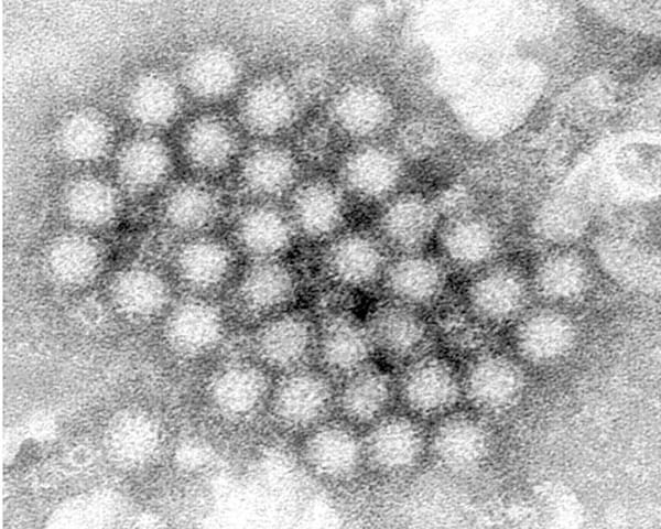 ¡EL NOROVIRUS REGRESA CON FUERZA Y LOS CASOS EN ESTADOS UNIDOS AUMENTAN NOTABLEMENTE!